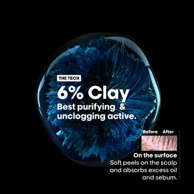 Scalp Advanced Anti-Oiliness Dermo-Purifier Shampoo - Serie Expert | L'Oréal Partner Shop