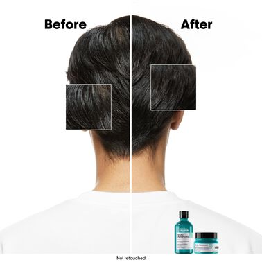 Scalp Advanced Anti-Oiliness Dermo-Purifier Shampoo - Serie Expert | L'Oréal Partner Shop