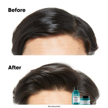Scalp Advanced Anti-Oiliness Dermo-Purifier Shampoo - Serie Expert | L'Oréal Partner Shop