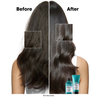 Scalp Advanced Anti-Discomfort Dermo-Regulator Shampoo - Serie Expert | L'Oréal Partner Shop