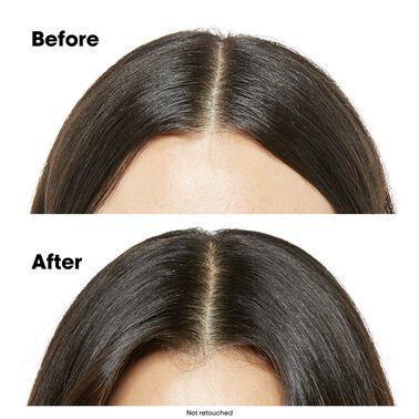 SCALP ADVANCED SPRING KIT - NEW! Spring Kits | L'Oréal Partner Shop