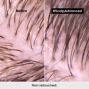 Scalp Advanced Anti-Oiliness Dermo-Purifier Shampoo - Serie Expert | L'Oréal Partner Shop