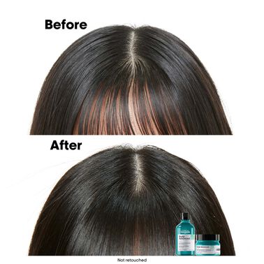 Scalp Advanced Anti-Oiliness Dermo-Purifier Shampoo - Serie Expert | L'Oréal Partner Shop