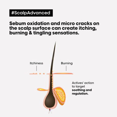 Scalp Advanced Anti-Oiliness Dermo-Purifier Shampoo - Serie Expert | L'Oréal Partner Shop