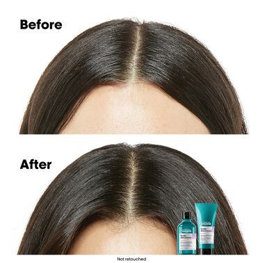 Scalp Advanced Anti-Discomfort Shampoo Refill - NEW! Refill | L'Oréal Partner Shop