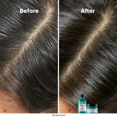 Scalp Advanced Anti-Oiliness Dermo-Purifier Shampoo - Serie Expert | L'Oréal Partner Shop