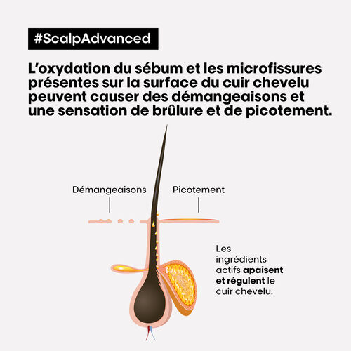 TRAITEMENT APAISANT INTENSE ANTI-INCONFORT SCALP Advanced - Serie Expert | L'Or&eacute;al Partner Shop