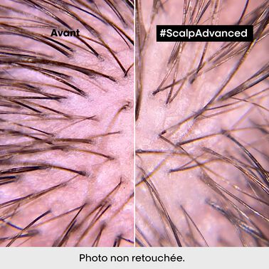 SHAMPOOING DERMO-RÉGULATEUR ANTI-INCONFORT SCALP Advanced - Serie Expert | L'Oréal Partner Shop