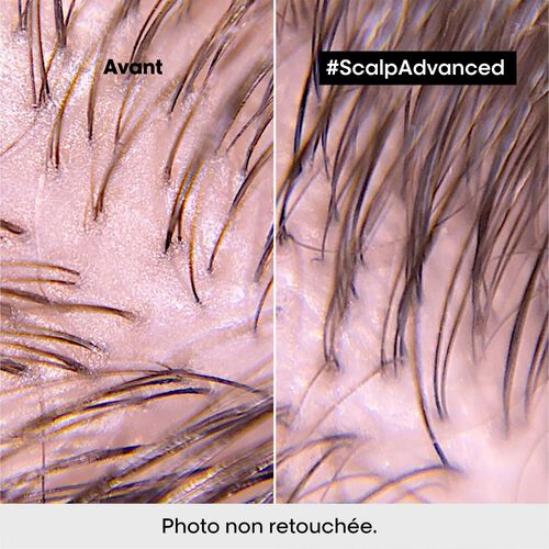 SHAMPOOING DERMO-PURIFIANT ANTI-GRAS SCALP Advanced - Scalp Advanced | L'Or&eacute;al Partner Shop
